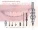 Dental Implant System OEM/ODM - Result of dental